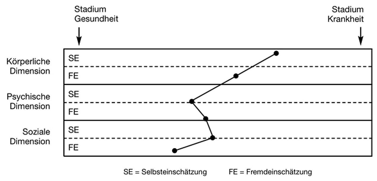 Abb. 2: Bestimmung von Gesundheit und Krankheit durch die Kombination von Selbsteinschätzung und Fremdeinschätzung (ursprünglich in: Hurrelmann 1988, hier übernommen aus: Hurrelmann & Richter 2013, S. 146)